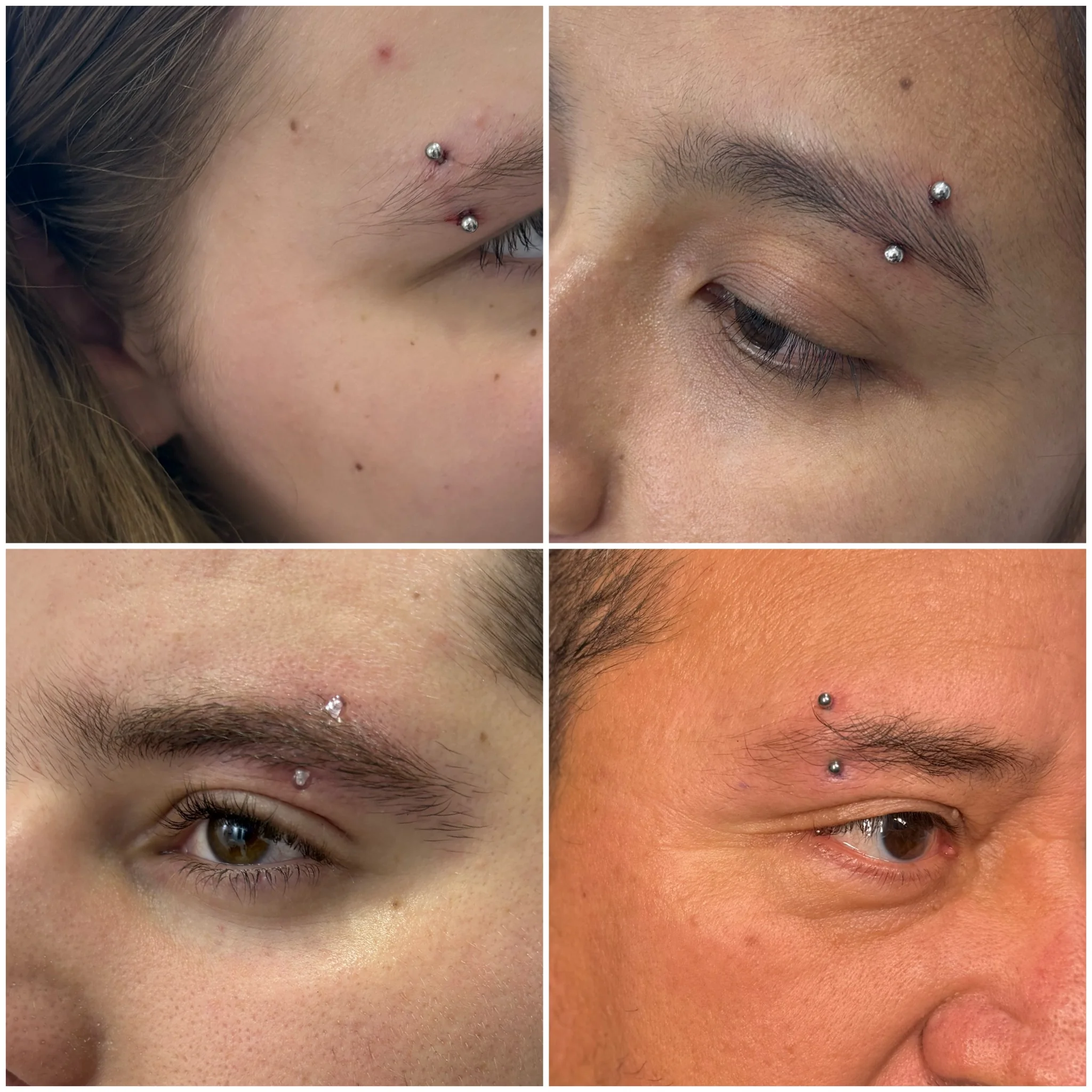 Microdermal piercing